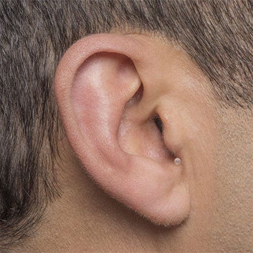 Invisible-In-Canal (IIC) – Virtually Invisible